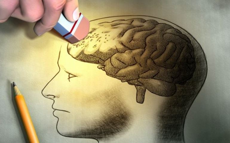 Novo método para detectar Alzheimer é testado com êxito no Japão