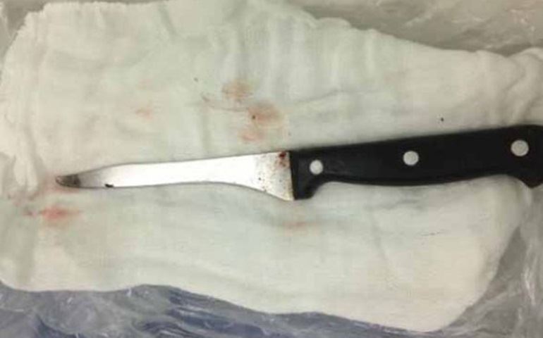 Em Agudos cirurgião que tirou faca da cabeça de trabalhador diz que vítima teve sorte