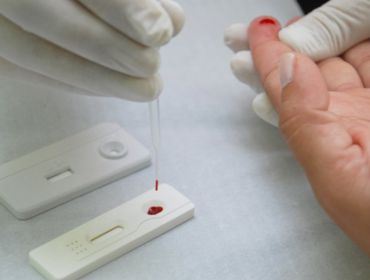 Unidades disponibilizam teste rápido de HIV e sífilis