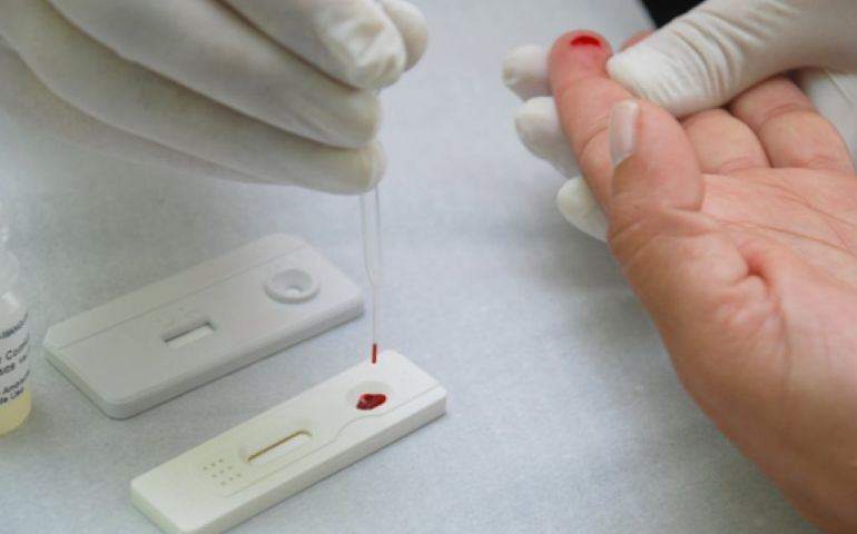 Unidades disponibilizam teste rápido de HIV e sífilis