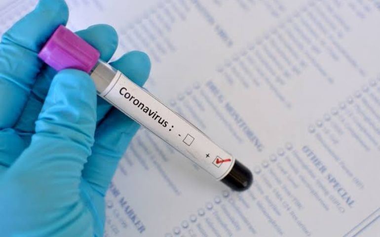 Vereador diz que Avaré faz poucos testes de Covid-19