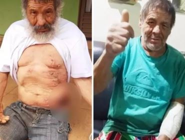 Morador de rua que foi queimado em praça recebe alta e é acolhido por lar de idosos em Buri